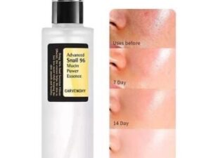 اسنس حلزون کوزارکس